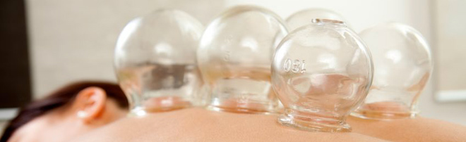 Therapieverfahren: Schröpfen